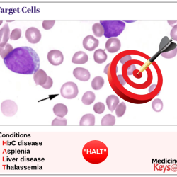 Target cells cell mexican hat rbc medicine blood academic ru thalassemia pathology similes metaphors part source