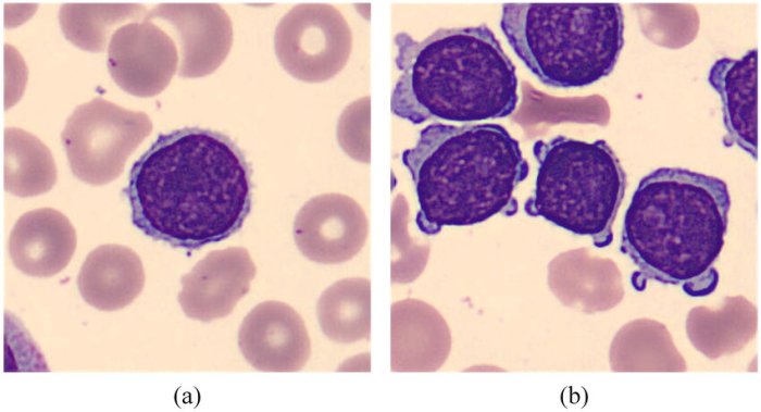 Cells target smear blood labs